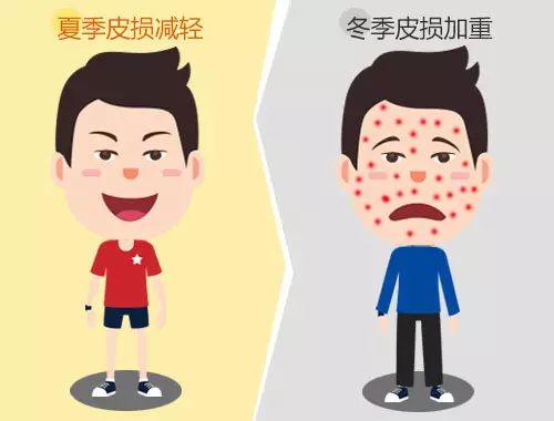 踏破铁鞋无觅处,治疗广州牛皮癣得来全不费功夫