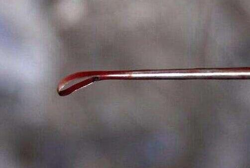 生姜擦头皮真的能生发吗