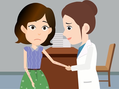 女性得了牛皮藓应该怎么治疗呢