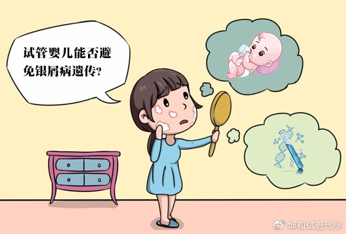 不看后悔!广州牛皮癣医院解析牛皮癣治疗小方法