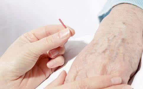 银屑病早期症状什么样