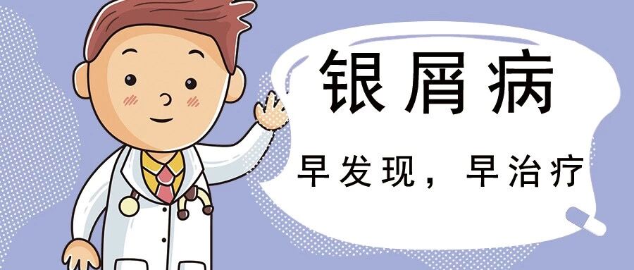 银屑病该如何治疗