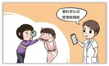 揭开银屑病的真面目