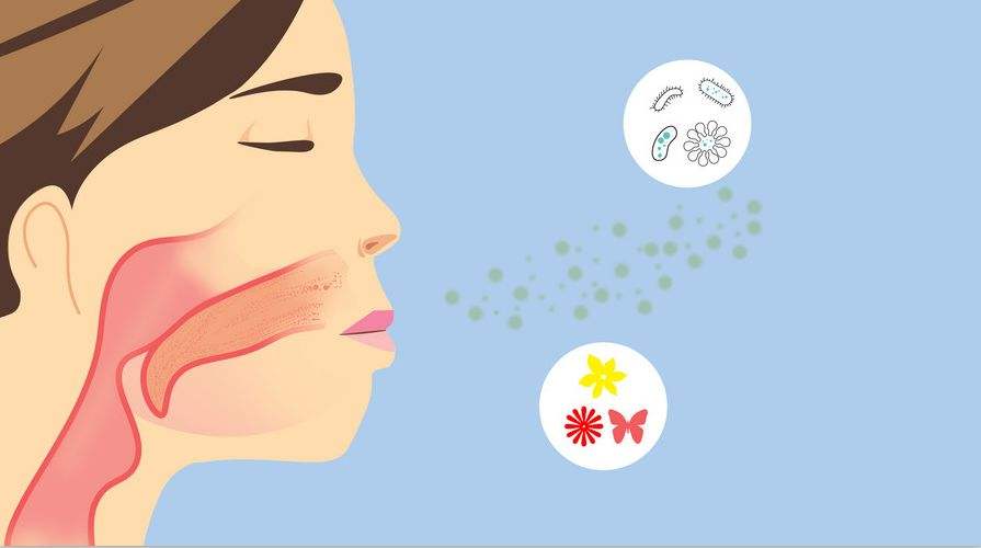 脸上不小心长银屑病问广州医生咋办