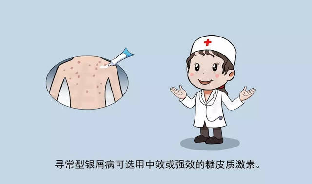 蛮横的牛皮癣,以及它如何影响到你的生活