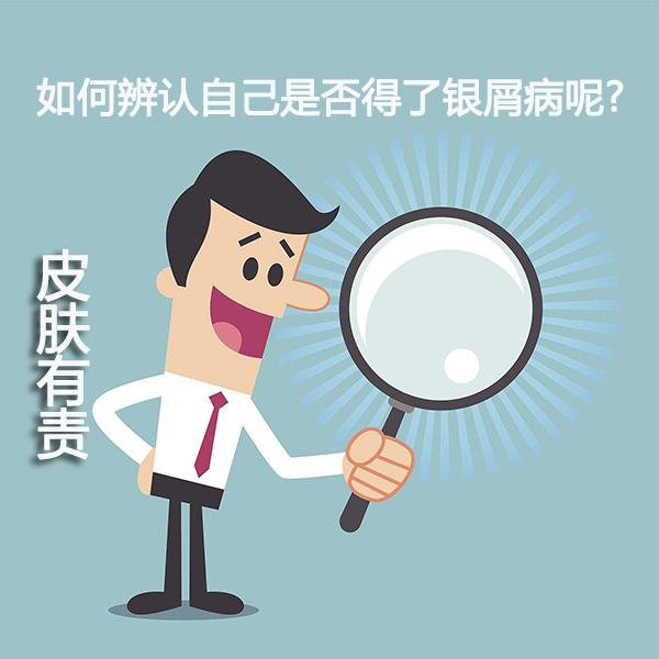 广州银屑病医院医院，牛皮鲜怎么治疗好