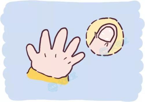 牛皮癣患者的护肤常识