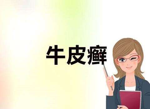 人到中年却突遇牛皮癣是怎么回事